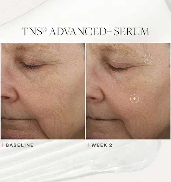 SkinMedica TNS Advanced+ Serum Our Premium Facial Skin Care Product, the Secret to Flawless Skin. Age-Defying Face Serum for Women is Proven to Address Wrinkles and Fine Lines for Glowing Skin, 1 Oz